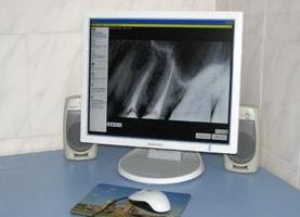 Co je rentgen pro zuby?