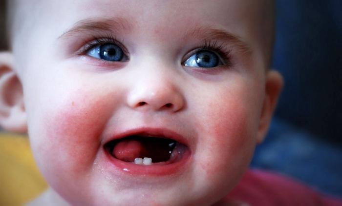 Jak se u kojenců vyskytuje klouby?